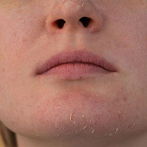Skinlastiq Medical Laser Cosmetic Spa treats dull skin