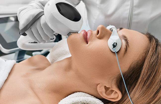 Patient receiving IPL treatments at Skinlastiq Medical Laser Cosmetic Spa in Burlingame