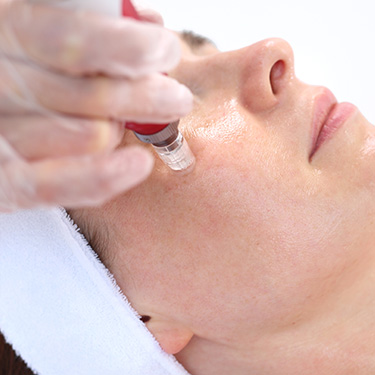 Patient receiving pep factor at Skinlastiq Medical Laser Cosmetic Spa in Burlingame