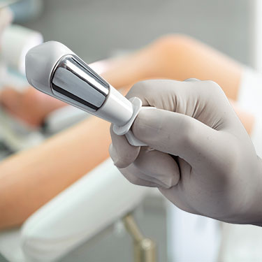 Patient receiving vtone for labiaplasty at Skinlastiq Medical Laser Cosmetic Spa in Burlingame